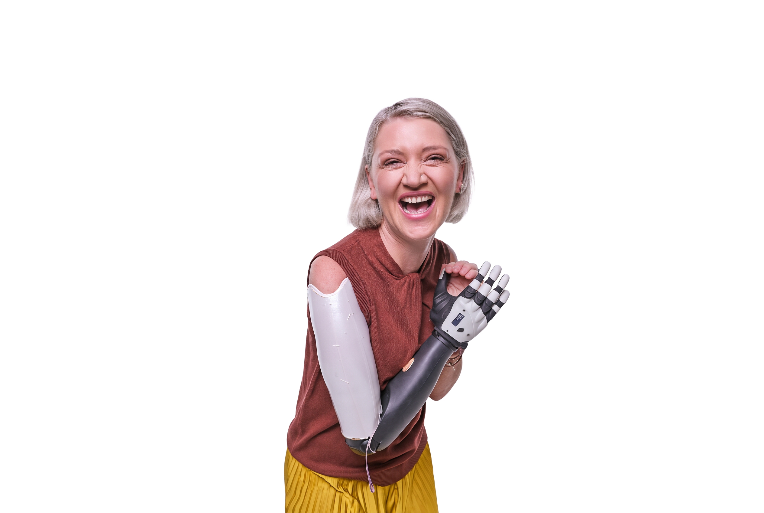 Woman smiling with a prosthetic arm